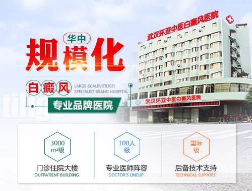 白癜风治疗